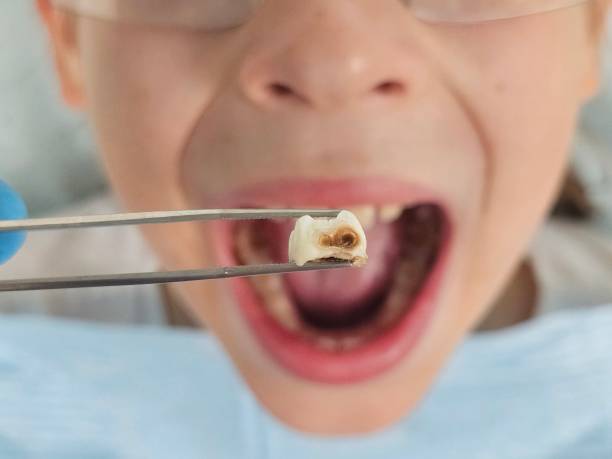 Best Pediatric Emergency Dentist in Saddle Rock, NY